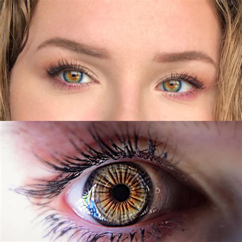 blue limbal ring